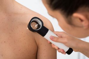 Leia mais sobre o artigo Maneiras de identificar o melanoma