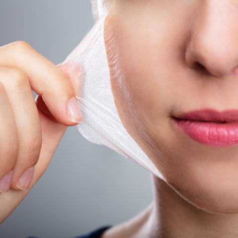 Peeling
