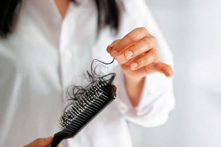 Read more about the article O que causa a queda de cabelo?